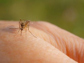 随着英国害虫数量的激增，护士揭示了为什么蚊子叮咬的人比其他人多